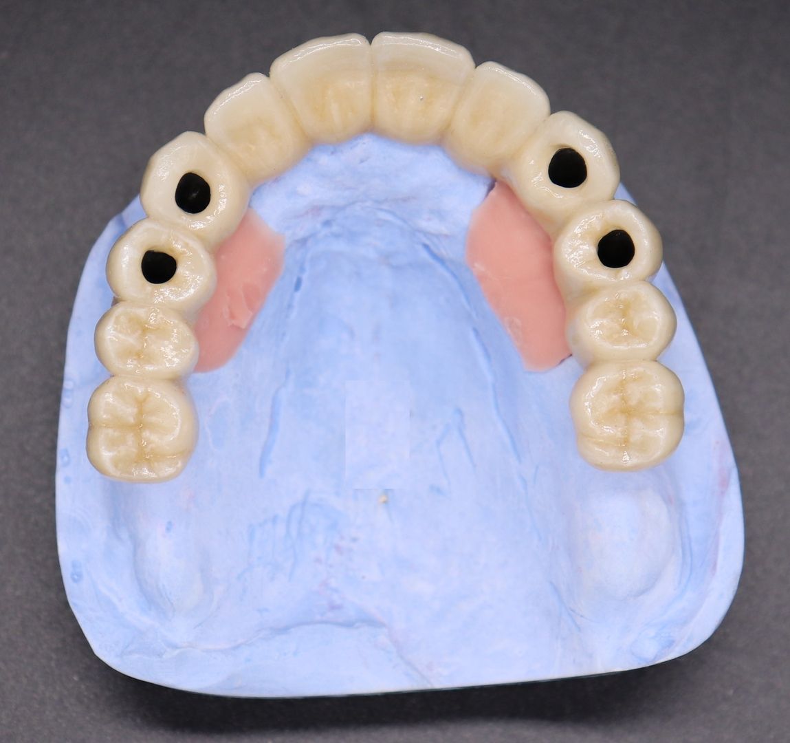 VierImplantate